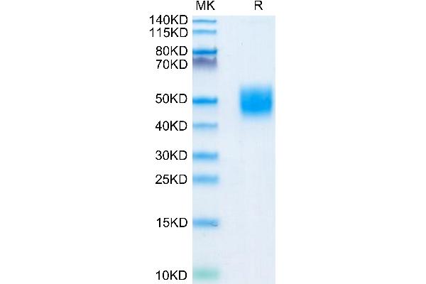 CD200 Protein (CD200) (AA 31-232) (His tag)
