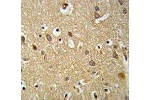 IGF1R antibody IHC analysis in formalin fixed and paraffin embedded brain tissue. (IGF1R antibody  (AA 51-77))