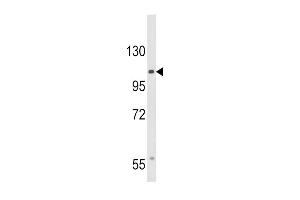 Western blot analysis of CACNA2D3 Antibody (C-term) (ABIN653695 and ABIN2843014) in HepG2 cell line lysates (35 μg/lane).