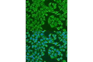 Immunofluorescence analysis of U2OS cells using IGF2BP3 antibody. (IGF2BP3 antibody  (AA 300-579))