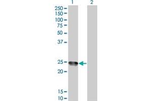 Western Blot analysis of AMELX expression in transfected 293T cell line by AMELX monoclonal antibody (M04), clone 6G3.