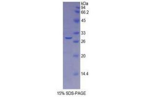 SDS-PAGE (SDS) image for Galactosidase, beta 1 (GLB1) (AA 192-432) protein (His tag) (ABIN2121095)