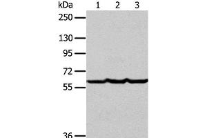 Western Blot analysis of Human liver cancer tissue, hela and Jurkat cell using Factor IX Polyclonal Antibody at dilution of 1:400 (Coagulation Factor IX antibody)