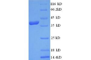 SDS-PAGE (SDS) image for Thymocyte Alloantigen (TTHY) (AA 23-147), (partial) protein (His-SUMO Tag) (ABIN5710560) (TTHY Protein (AA 23-147, partial) (His-SUMO Tag))