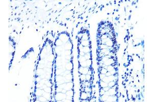 Immunohistochemistry of paraffin-embedded human colon using U2/U2/U2 Rabbit mAb (ABIN1682786, ABIN3019042, ABIN3019043 and ABIN7101704) at dilution of 1:100 (40x lens). (U2AF2 antibody)