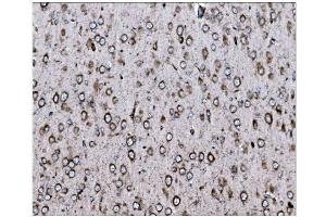 anti-Low Density Lipoprotein Receptor-Related Protein 1B (LRP1B) (AA 3704-4547) antibody