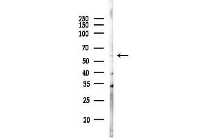 anti-Zinc Finger Protein 18 (ZNF18) (C-Term) antibody