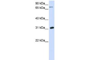 WB Suggested Anti-UPP1 Antibody Titration:  0. (UPP1 antibody  (N-Term))