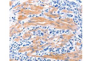 Immunohistochemistry (IHC) image for anti-Growth Differentiation Factor 9 (GDF9) (AA 205-454) antibody (ABIN3016573) (GDF9 antibody  (AA 205-454))