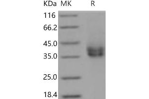 FCAR Protein (His tag)