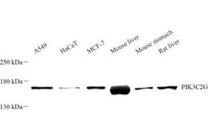 Western blot analysis of PIK3C2G (ABIN7075042) at dilution of 1: 500 (PIK3C2G antibody)