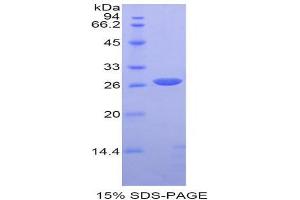 SDS-PAGE (SDS) image for Spectrin alpha Chain, Brain (SPTAN1) (AA 402-599) protein (His tag) (ABIN1877385) (SPTAN1 Protein (AA 402-599) (His tag))