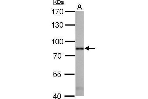 Radixin antibody