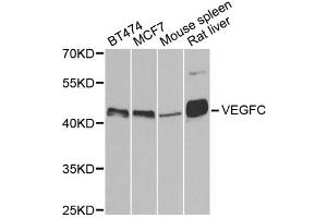 Western blot analysis of extracts of various cell lines, using VEGFC antibody (ABIN5971381) at 1/500 dilution.