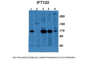 Sample Type: 1. (IFT122 antibody  (C-Term))