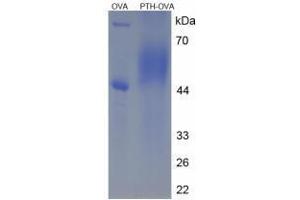 Image no. 3 for Parathyroid Hormone (PTH) peptide (Ovalbumin) (ABIN5666326) (Parathyroid Hormone (PTH) peptide (Ovalbumin))