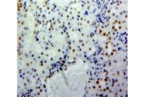Used in DAB staining on fromalin fixed paraffin-embedded Kidney tissue (SLC9A3R2 antibody  (AA 56-326))
