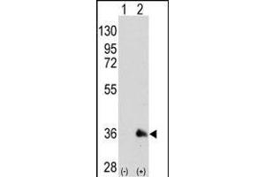 Western blot analysis of SOX2 (arrow) using mouse monoclonal SOX2 antibody (ABIN387798 and ABIN2843854).