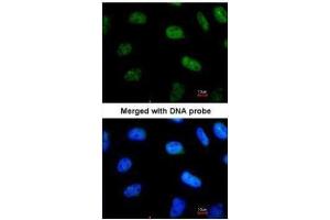 Immunofluorescence (IF) image for anti-Signal Transducer and Activator of Transcription 3 (Acute-Phase Response Factor) (STAT3) (C-Term) antibody (ABIN2855865)