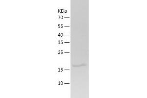 ADRA2B Protein (AA 202-370) (His tag)