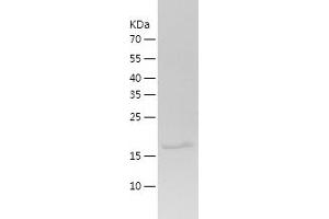 Western Blotting (WB) image for Adrenergic, alpha-2B-, Receptor (ADRA2B) (AA 202-370) protein (His tag) (ABIN7282294) (ADRA2B Protein (AA 202-370) (His tag))