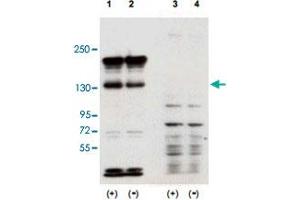 Western blot using Sipa1 polyclonal antibody  shows detection of over-expressed Sipa1 in lysates from mouse NIH/3T3 cells transfected with Sipa1 (Lane 1). (SIPA1 antibody  (N-Term))