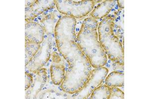 Immunohistochemistry of paraffin-embedded mouse kidney using ARFGAP1 antibody (ABIN5974280) at dilution of 1/100 (40x lens).