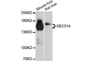 Western blot analysis of extracts of mouse liver and rat liver cell lines, using SEC31A antibody.