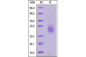 Cynomolgus TREM2, His Tag on  under reducing (R) condition. (TREM2 Protein (AA 19-174) (His tag))