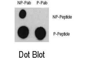 Image no. 1 for anti-Activating Transcription Factor 2 (ATF2) (pSer322) antibody (ABIN358324) (ATF2 antibody  (pSer322))