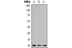 Western blot analysis of Apelin expression in 22RV1 (A), MCF7 (B), mouse brain (C) whole cell lysates. (Apelin antibody  (C-Term))