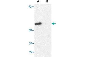 Western blot analysis of GPR44 in Jurkat cell lysate with GPR44 polyclonal antibody  at 1 ug/mL in (A) the absence and (B) presence of blocking peptide.