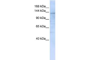 WB Suggested Anti-IMPG2 Antibody Titration:  0. (IMPG2 antibody  (C-Term))