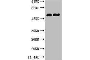 Western blot analysis of 1) Mouse Brain tissue, 2) Rat Brain tissue, diluted at 1:100000. (TUBB2A antibody)