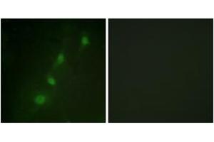 Immunofluorescence analysis of HeLa cells, using SGK (Ab-78) Antibody. (SGK1 antibody  (AA 41-90))