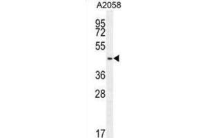 Western Blotting (WB) image for anti-DDB1 and CUL4 Associated Factor 4-Like 2 (DCAF4L2) antibody (ABIN2995734) (DCAF4L2 antibody)