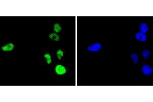 HeLa cells were fixed in paraformaldehyde, permeabilized with 0. (C-JUN antibody)