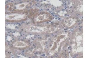 DAB staining on IHC-P; Samples: Human Kidney Tissue (TASP1 antibody  (AA 234-420))
