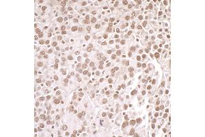 Immunohistochemistry (IHC) image for anti-Protein Arginine Methyltransferase 1 (PRMT1) (AA 1-50) antibody (ABIN7453933)