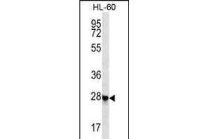 C Antibody (N-term) (ABIN656356 and ABIN2845654) western blot analysis in HL-60 cell line lysates (35 μg/lane). (Chromosome 12 Open Reading Frame 52 (C12orf52) (AA 44-72), (N-Term) antibody)