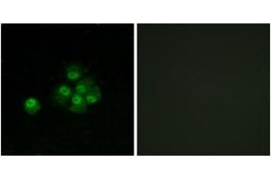 Immunofluorescence (IF) image for anti-Insulin Receptor Substrate 1 (IRS1) (pSer636) antibody (ABIN2888449) (IRS1 antibody  (pSer636))