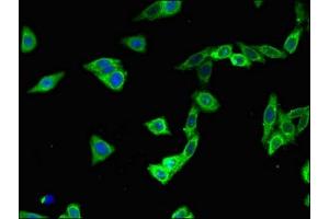 Immunofluorescent analysis of HepG2 cells using ABIN7163637 at dilution of 1:100 and Alexa Fluor 488-congugated AffiniPure Goat Anti-Rabbit IgG(H+L) (PLEKHA7 antibody  (AA 294-654))