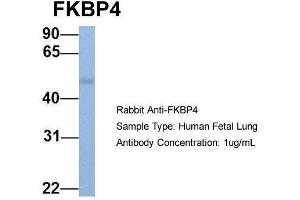 Host:  Rabbit  Target Name:  FKBP4  Sample Type:  Human Fetal Lung  Antibody Dilution:  1. (FKBP4 antibody  (C-Term))