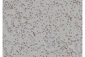 ABIN6257812 and ABIN6273635 at 1/100 staining Rat kidney tissue by IHC-P. (HSPB3 antibody  (Internal Region))