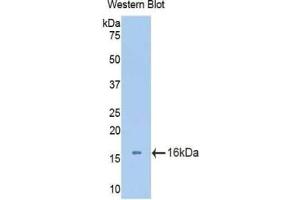 Western blot analysis of the recombinant protein. (Aggrecan antibody  (AA 34-147))