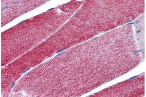 Immunohistochemistry (Formalin-fixed Paraffin-embedded Sections) (IHC (fp)) image for anti-Isocitrate Dehydrogenase 2 (NADP+), Mitochondrial (IDH2) (AA 354-452) antibody (ABIN574283)