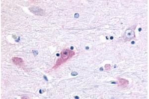 Anti-ROR Beta antibody  ABIN1049295 IHC staining of human brain, thalamus. (RORB antibody  (Ligand Binding Domain))