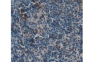 Immunohistochemistry (IHC) image for anti-Glucose-6-Phosphate Dehydrogenase (G6PD) (AA 1-515) antibody (ABIN1173474)
