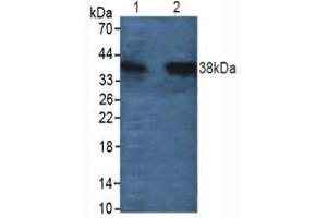 Figure. (Cathepsin L antibody  (AA 114-288))