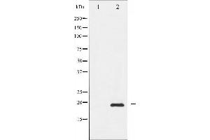Western blot analysis of Survivin phosphorylation expression in A549 whole cell lysates,The lane on the left is treated with the antigen-specific peptide. (Survivin antibody  (pThr117))